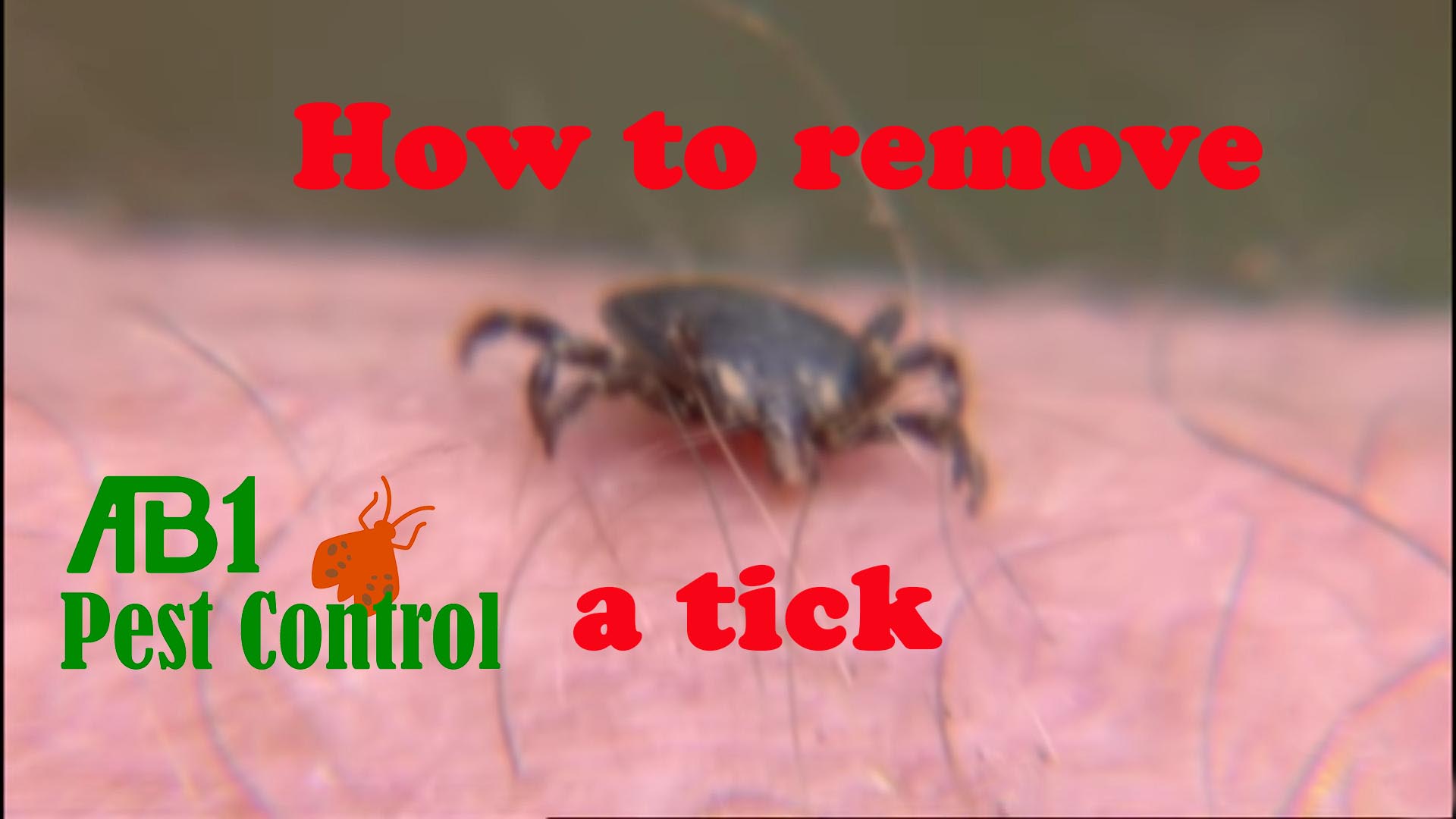 How To Remove A Tck